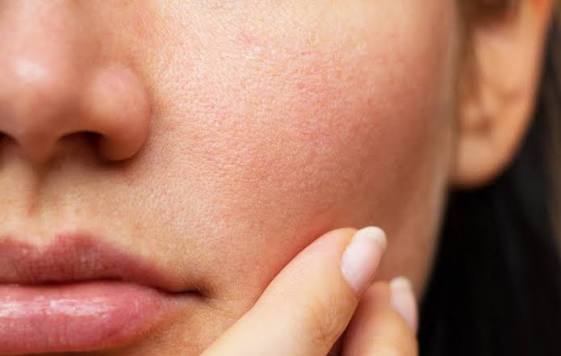Bí quyết hạn chế khô căng và duy trì làn da mềm mịn