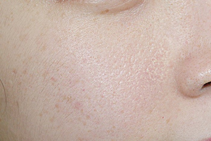 Bí quyết hạn chế khô căng và duy trì làn da mềm mịn
